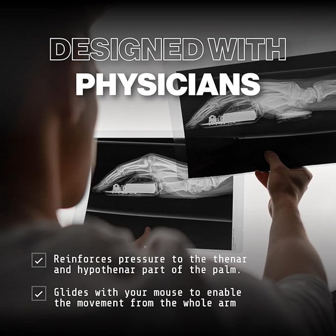 DELTAHUB Carpio 2.0 - Left-Handed Truly Ergonomic Wrist Rest for Mouse, Carpal Tunnel Support, Pain Relief, Anti-Fatigue, Easy Glide, Sleek, Office Computer, Laptop, Gaming - Small, Black